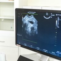 2026年1月12日_動物看護士のおしごと_